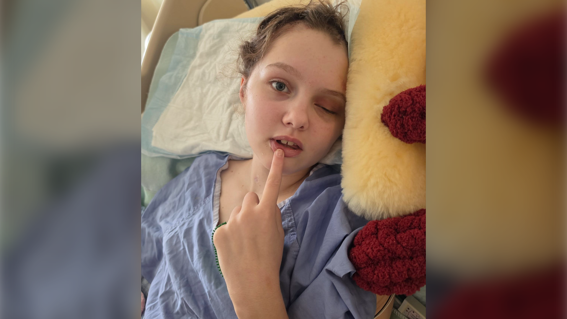 Father of Tumbler Ridge shooting survivor says Maya is trending in right direction after surgery