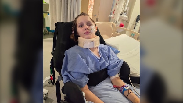 Surgery to repair skull a success for Tumbler Ridge shooting victim Maya Gebala
