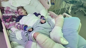 ‘It was horrific’: B.C. teen with special needs seriously burned in bath while in ministry care