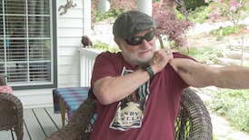 ‘I couldn’t believe it’: Man attacked by bear in Mission, B.C. 
