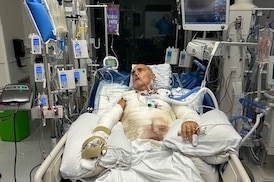 Montreal man sues Ferrari Quebec after life-threatening injuries caused by explosion of Luc Poirier’s car at dealership