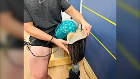New technology will transform prosthetics, SFU researchers say