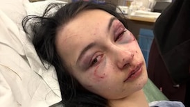 ‘Horrifying’: 2 teens charged in assault that left girl seriously injured in Red Deer 